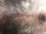 Atoická dermatitis