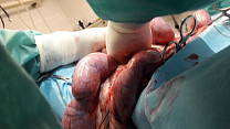 Pyometra 