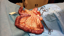 Pyometra 