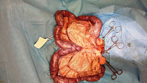 Pyometra 